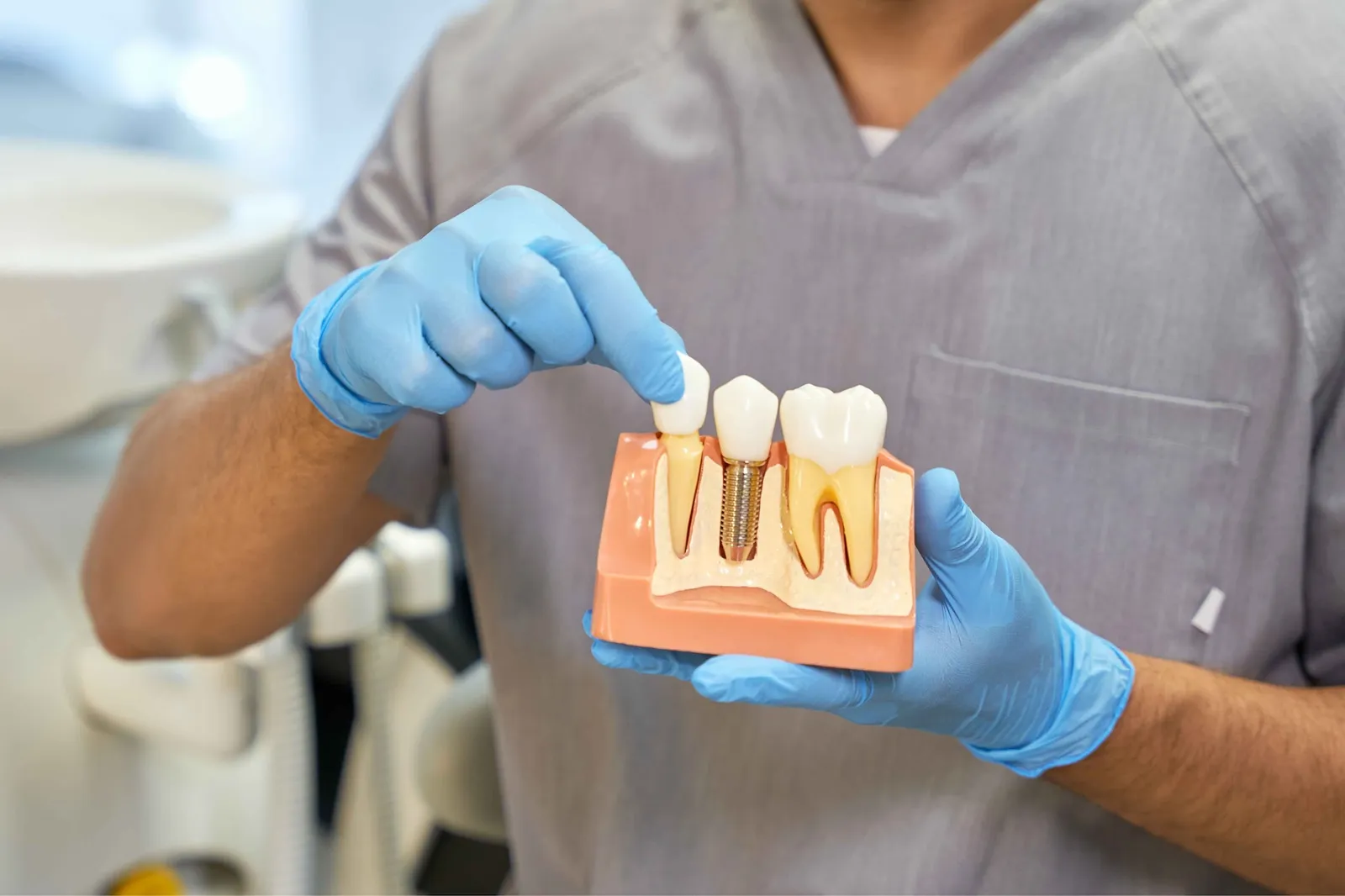 Dental model showing a single tooth implant supporting a replacement crown